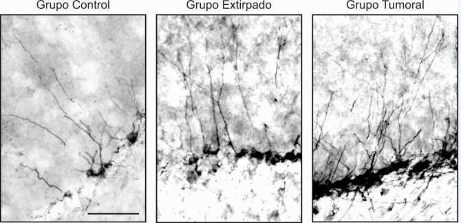 Revelan el importante papel de la hormona del crecimiento en el aprendizaje