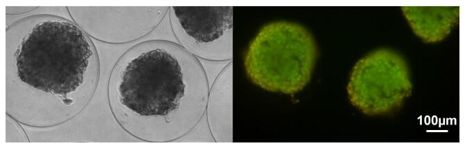 Un nuevo sistema para el tratamiento de la diabetes mellitus tipo 1