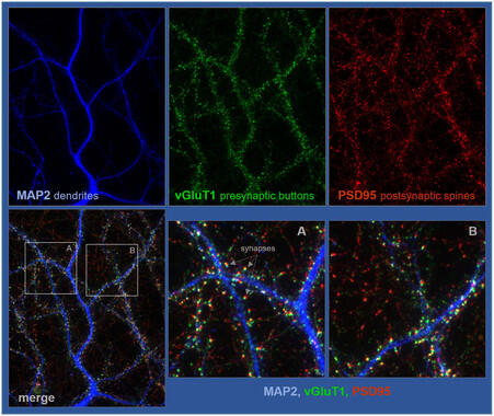 Una proteína cerebral promueve la interconectividad neuronal