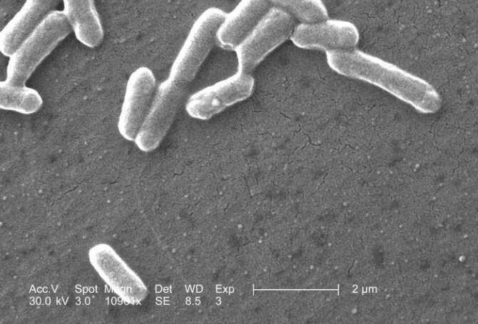 Virus para controlar la bacteria Escherichia coli