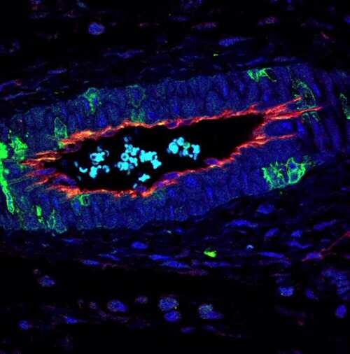 Una proteína regula la formación de vasos sanguíneos en los tumores