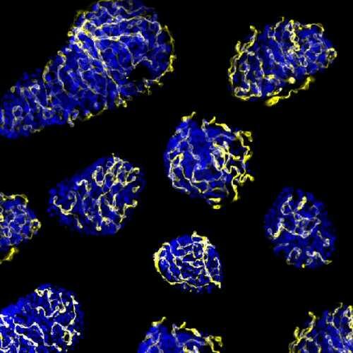 Mecanismo para mejorar el trasplante de islotes pancreáticos en diabetes de tipo 1