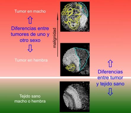 Identifican genes relacionados con la agresividad del cáncer según el sexo