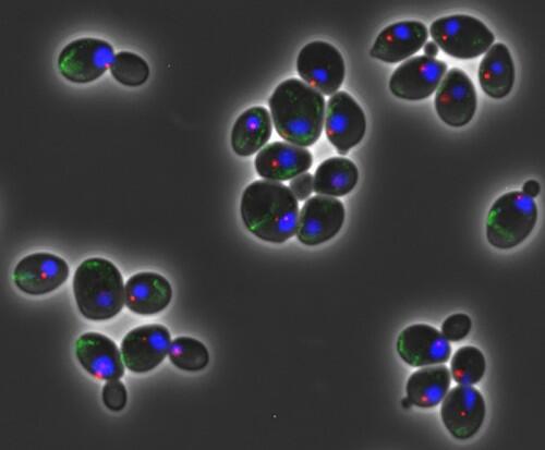 Un estudio del CSIC explica un nuevo mecanismo que lleva al envejecimiento prematuro de las células madre