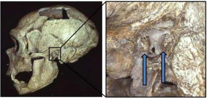 Un neandertal discapacitado recibió cuidados para llegar a la vejez