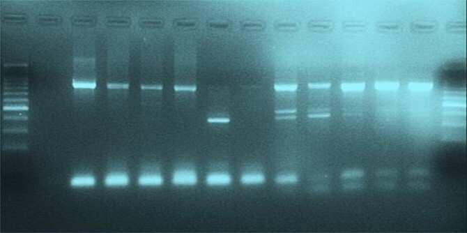 Detección rápida de la bacteria de la legionelosis en el aire