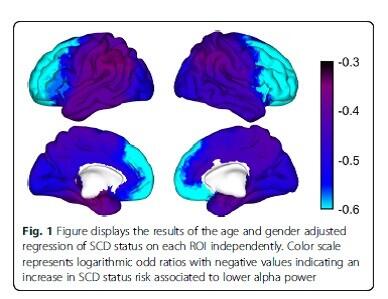 Avances para la detección precoz e individualizada del alzheimer