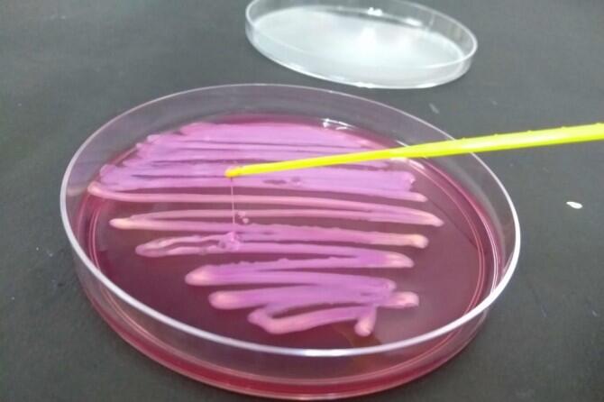 Detectadas bacterias multirresistentes fuera de ambientes hospitalarios