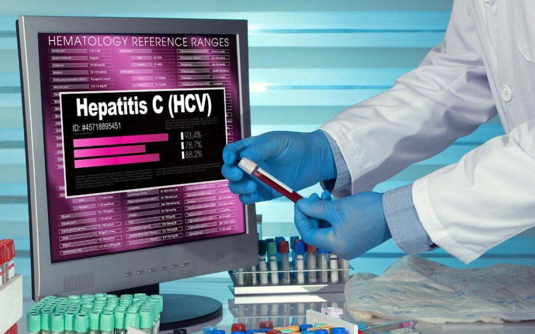 Día Internacional de la Hepatitis C, cada año mata a  400 mil personas