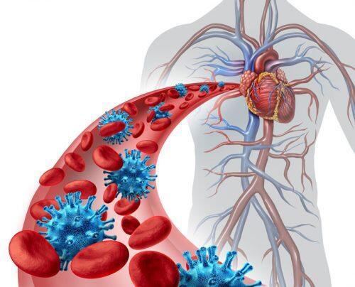 Blood virus infection medical concept as a human body with an artery showing microscopic pathogen and red cells at risk of disease coming from the cardiovascilar system with 3D illustration elements.