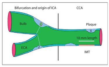 ej-vol13n21-figure2_escardio-hPhotoMedium