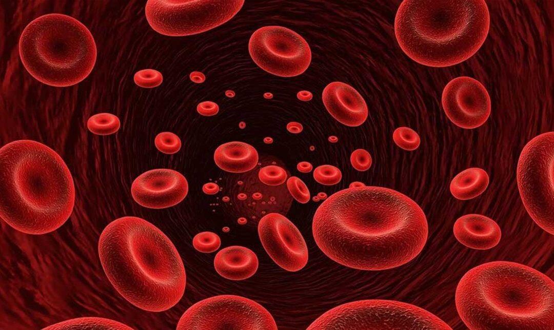 توصيات هامّة لمرضى فقر الدم خلال الصوم